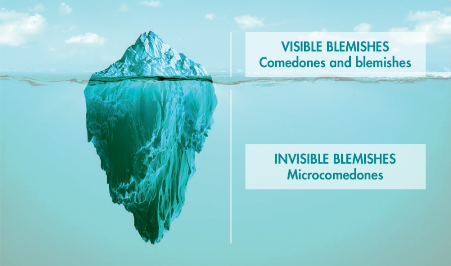 iceberg