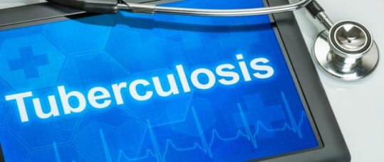 TB cases in non-UK born population decline