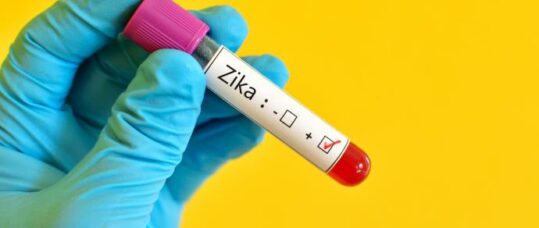 Health leaders to decide if Zika is a international health emergency