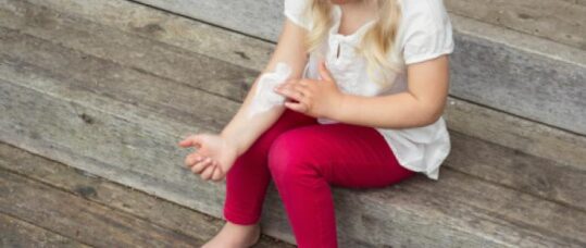 Blog: Topical corticosteroids – why the fear?