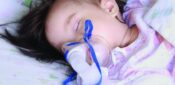 Managing infants with bronchiolitis