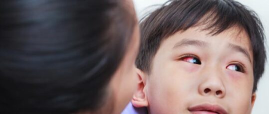 Advice for parents on conjunctivitis: Don’t go to GP