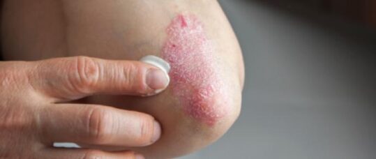 Blog: How to advise dermatology patients