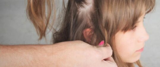 Head lice prevention, diagnosis and treatment