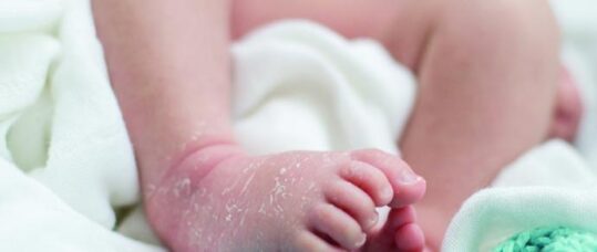 Treating dry skin conditions in children and babies