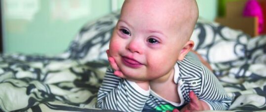 Supporting parents of children with Down’s syndrome