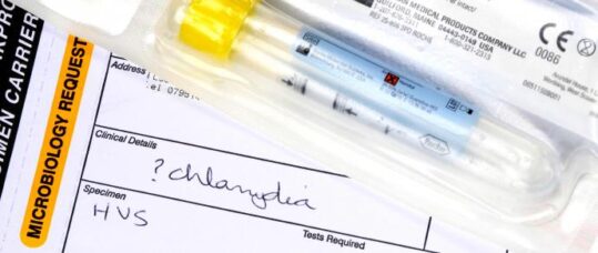 Chlamydia screening drops by 11% in general practice