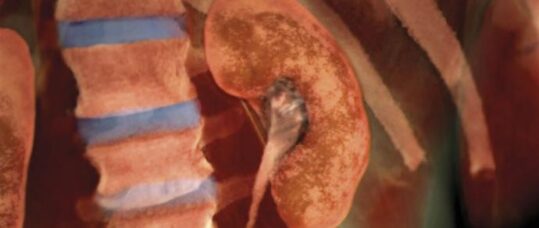 CPD – In review: Chronic kidney disease