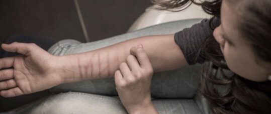 More than one fifth of 14-year-old girls self harm, survey finds