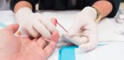 HIV infections could increase due to Covid-19 disruptions