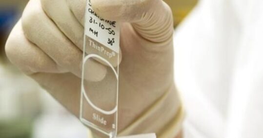 NHS England to start issuing cervical screening invitations again from this month