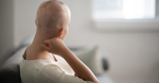 Covid-19 could cause 35,000 excess cancer deaths