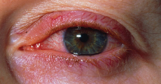 Picture quiz – eye presentations