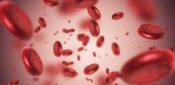 What to look out for in a suspected case of anaemia