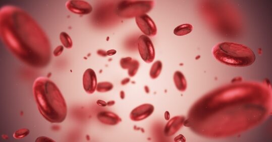 What to look out for in a suspected case of anaemia