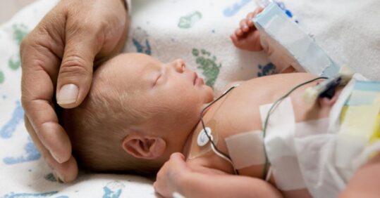 Premature birth associated with reduced brain connections