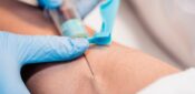 Practices must still ration blood tests despite emergency tube order, says NHS England