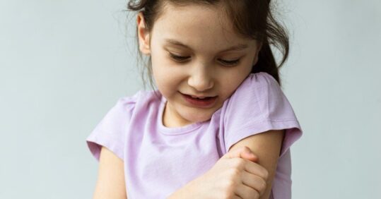 Managing atopic eczema in children under 12 years