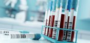 Blood test could spot cancer in people with ‘nonspecific symptoms’