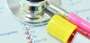 Primary hypothyroidism – issues in diagnosis and management