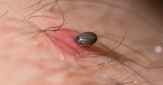 Ten top tips for nurses on Lyme disease