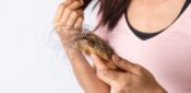 Hair loss and low libido among long Covid symptoms, study finds