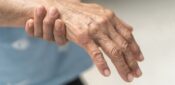 Three-minute skin swab can diagnose Parkinson’s