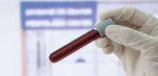Research update: Communication breakdown over blood tests, and GP work in A&E