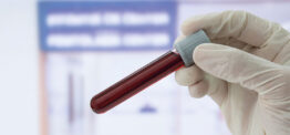 Research update: Communication breakdown over blood tests, and GP work in A&E