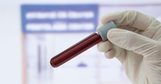 Research update: Communication breakdown over blood tests, and GP work in A&E