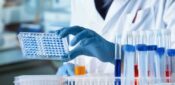 New blood signature detection enables early diagnosis of prediabetes, study suggests