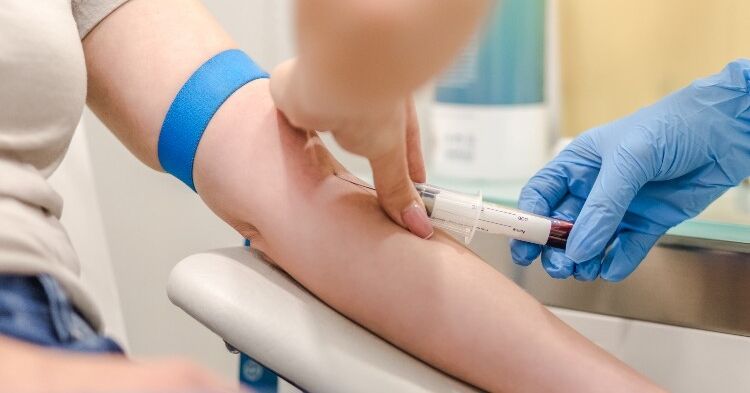 Interstitial fluid sampling from skin could be less painful alternative to blood tests
