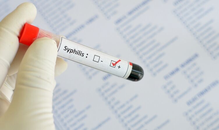 Syphilis – don’t miss it!