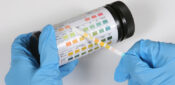 Practice nurse led treatment more effective for male UTIs