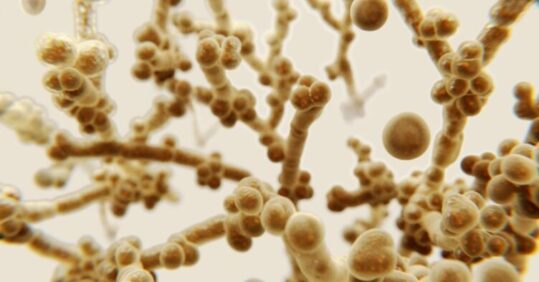 Candida auris infection spread in US ‘really concerning’