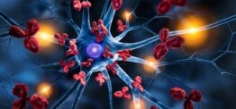 Autoimmune disease increase linked to lifestyle risk factors