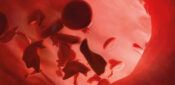 Q&A: Understanding sickle cell