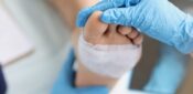 General practice pressures adding to wound care priority issues, report finds