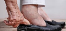 Mythbuster: ‘Her ankles are very swollen – she needs water tablets’